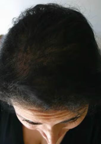 José L. (35 años)